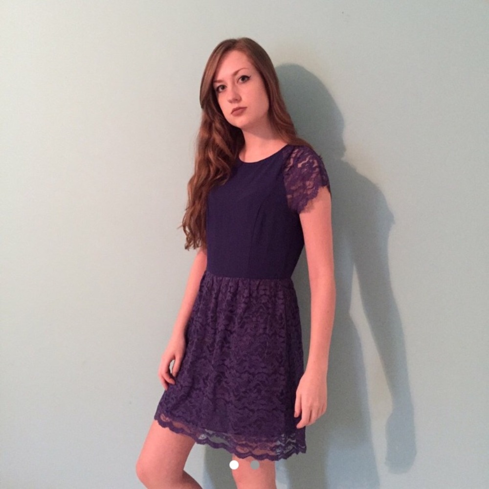 Urban Outfitters Pins and Needles Lace Dress